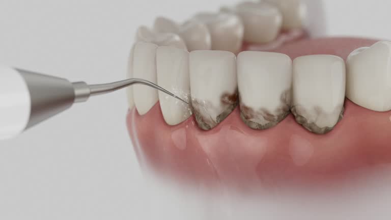 Reliable Dental contractor in Collierville, CA by Dentist Open Now